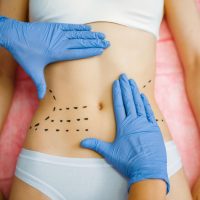 cosmetician-39-s-hands-on-female-patient-abdomen.jpg